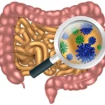 Paso 5 - Descartar infecciones en el intestino delgado (conocido como SIBO: Small Intestine Bacterial Overgrowth)